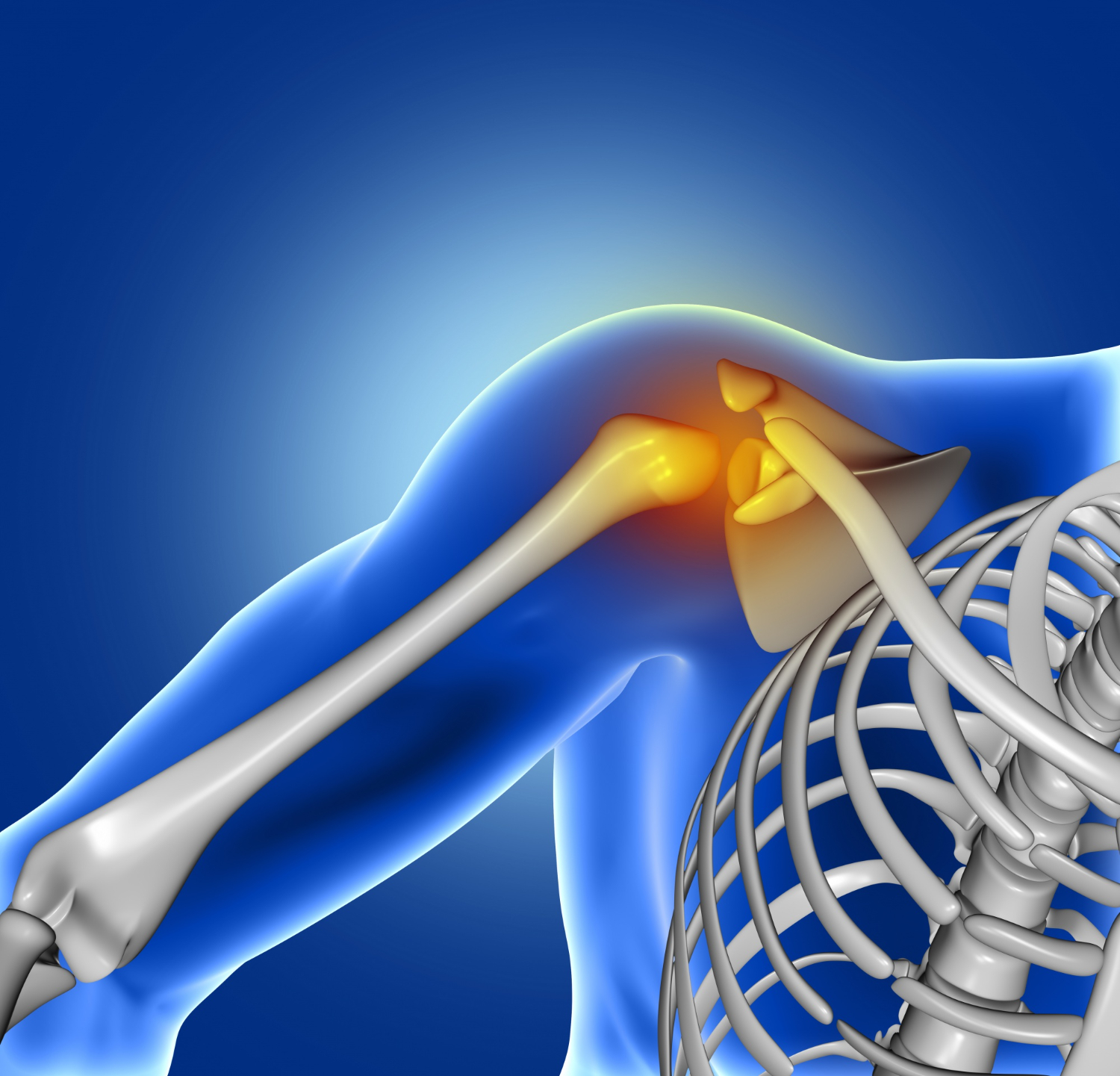 Joint Dislocations